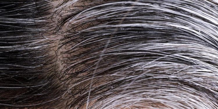 Gray hair