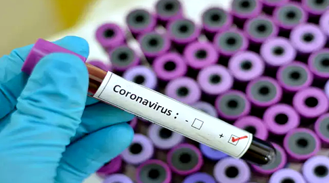 New testing approach for COVID-19 developed that could catch infection hours after exposure: Study