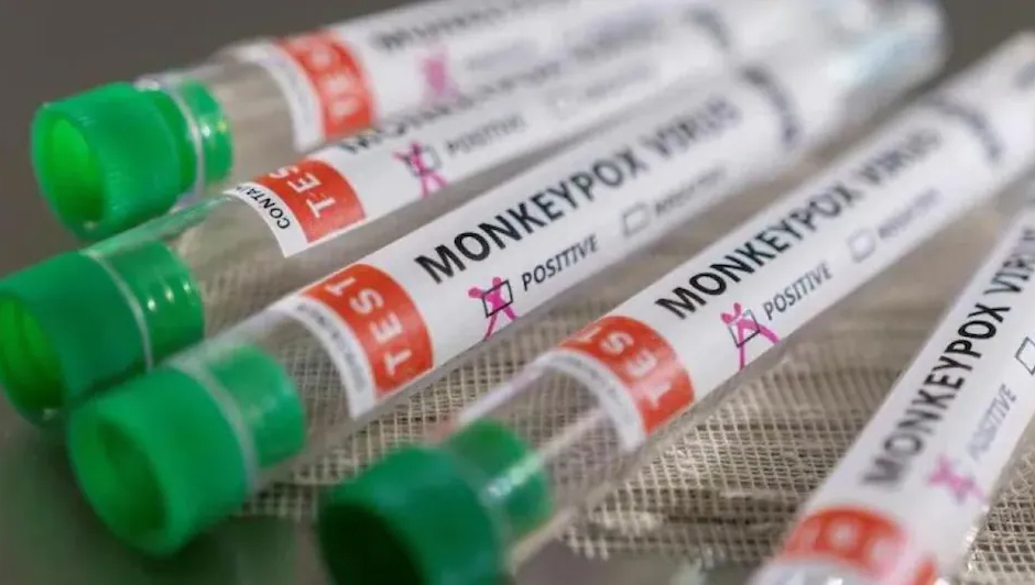 Monkeypox