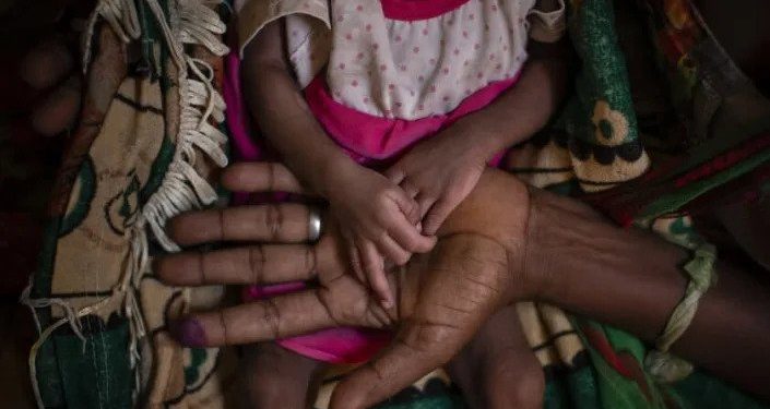 A woman holds the hands of her malnourished daughter inside a medical tent last year in the Tigray region of northern Ethiopia. (Ben Curtis / Associated Press via news.yahoo.com)