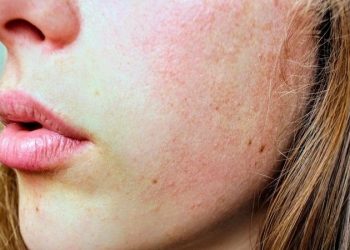 Skin Slugging: Ace your winter glow(IANSLIFE)