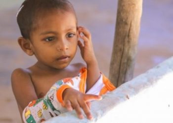 A Malnutritioned Sri Lankan Kid