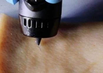 New wound-healing ink repairs cuts with a 3D-printing pen