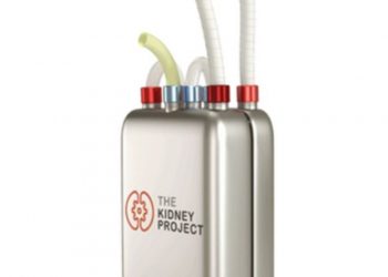 Artificial kidney, dialysis