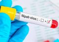 Nipah Virus