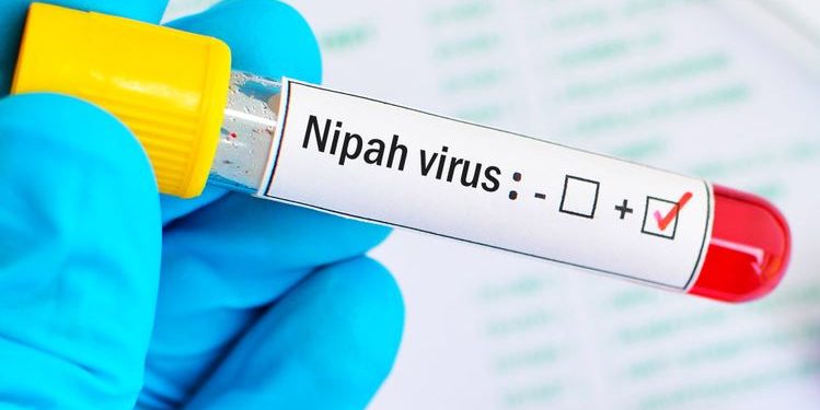 Nipah Virus