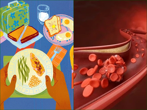 Protein intake and arteries