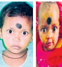 Sisters die due to food poisoning in Keonjhar district
