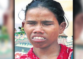visually impaired beggar