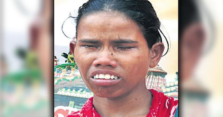 visually impaired beggar