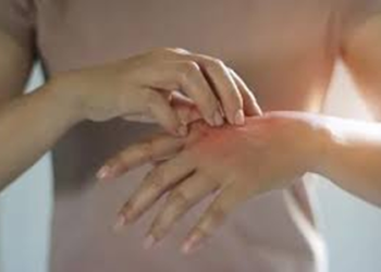 hand-foot-mouth disease