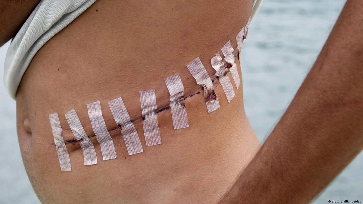 Two Odisha men fall victim to Kerala organ trafficking racket