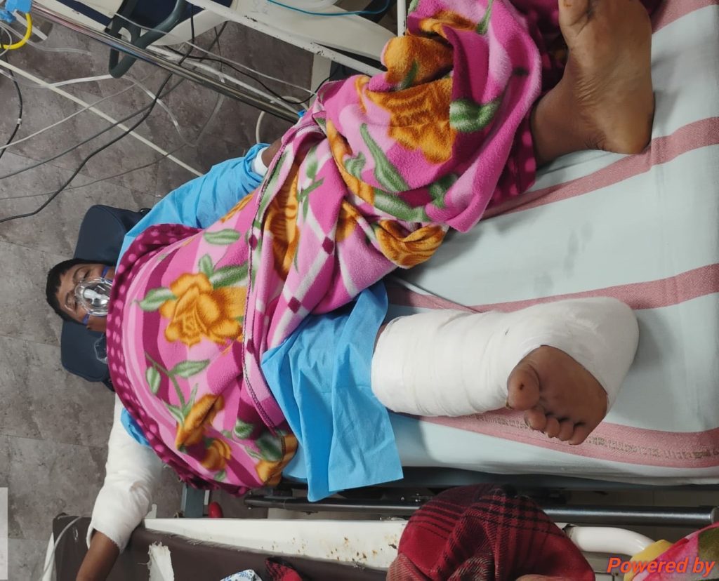 Gajamitra critical after coming in contact with poachers’ live wire trap