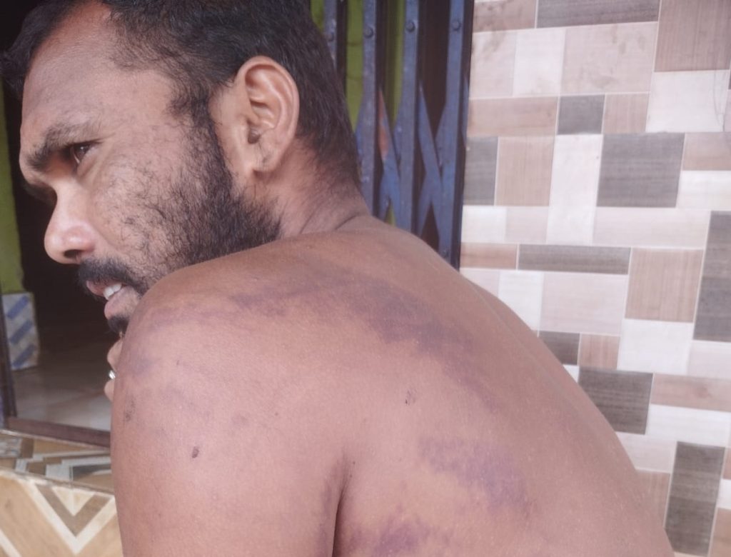 Two Koraput men critical after custodial torture by AP Police