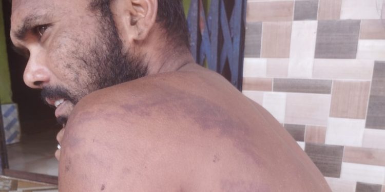 Two Koraput men critical after custodial torture by AP Police